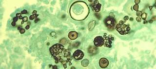 Spores of the fungal pathogen Coccidioides live in the soil and infect an estimated 150,000 people annually Spores of the fungal pathogen Coccidioides live in the soil and infect an estimated 150,000 people annually
