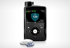 The 'Artificial Pancreas' Has Arrived The 'Artificial Pancreas' Has Arrived