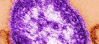 Nearly all who were infected had not been vaccinated Nearly all who were infected had not been vaccinated