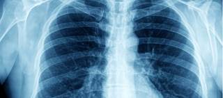 A second opinion could have improved the outcomes A second opinion could have improved the outcomes