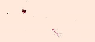 S. maltophilia infections are known as being inherently resistant with limited treatment options S. maltophilia infections are known as being inherently resistant with limited treatment options