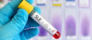 Long-term safety and efficacy of Benlysta in patients with systemic lupus erythematosus has been released Long-term safety and efficacy of Benlysta in patients with systemic lupus erythematosus has been released