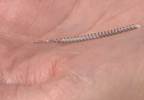 FDA Puts New Restrictions on Permanent Birth Control Implant Essure FDA Puts New Restrictions on Permanent Birth Control Implant Essure