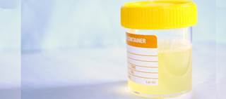 2011 CPG on UTI in infants and young children reaffirmed 2011 CPG on UTI in infants and young children reaffirmed