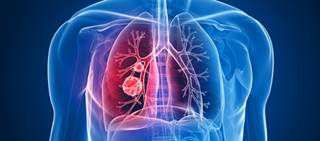 Lorlatinib is a next-generation ALK/ROS1 tyrosine kinase inhibitor Lorlatinib is a next-generation ALK/ROS1 tyrosine kinase inhibitor
