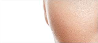 Laser group has discrete superiority at two months of treatment; better results in the sixth month Laser group has discrete superiority at two months of treatment; better results in the sixth month