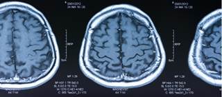 Resilient adolescent females have greater connectivity within frontal and limbic networks Resilient adolescent females have greater connectivity within frontal and limbic networks