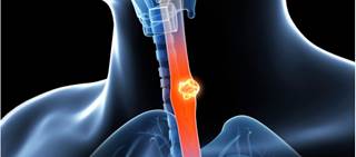 The test measures five chemicals in the breath The test measures five chemicals in the breath