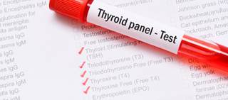 Brand vs. generic Synthroid compared for TSH lab results Brand vs. generic Synthroid compared for TSH lab results