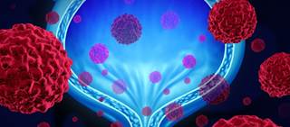 Avelumab is currently under investigation in a clinical development program including nine Phase 3 trials Avelumab is currently under investigation in a clinical development program including nine Phase 3 trials
