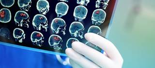 More midlife FLEs, especially relating to interpersonal relationships, tied to advanced predicted brain aging More midlife FLEs, especially relating to interpersonal relationships, tied to advanced predicted brain aging