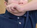 Prevalence of Obese, Allergic Asthma Phenotypes Examined in US Children Prevalence of Obese, Allergic Asthma Phenotypes Examined in US Children