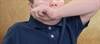 Prevalence of Obese, Allergic Asthma Phenotypes Examined in US Children Prevalence of Obese, Allergic Asthma Phenotypes Examined in US Children