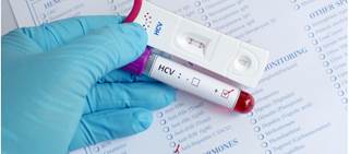 It is possible that the hepatitis virus or its treatment could play a role in triggering Parkinson disease. It is possible that the hepatitis virus or its treatment could play a role in triggering Parkinson disease.
