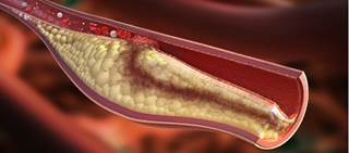Continuing medications up to and on operation day linked to better survival rates in study Continuing medications up to and on operation day linked to better survival rates in study