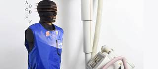Researchers found the average radiation doses to the unprotected brain, carotid arteries, and ocular lenses was 8.4, 17, and 50%, respectively Researchers found the average radiation doses to the unprotected brain, carotid arteries, and ocular lenses was 8.4, 17, and 50%, respectively