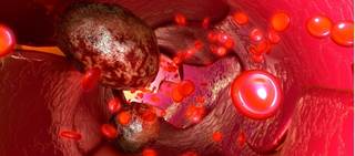 Antagonistic anti-OX40 antibody triggers T-cell immune response specific to tumor antigens Antagonistic anti-OX40 antibody triggers T-cell immune response specific to tumor antigens