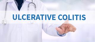 Ulcerative colitis (UC) affects greater than 900,000 Americans Ulcerative colitis (UC) affects greater than 900,000 Americans