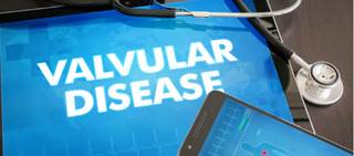 Valvular heart disease guidelines updated Valvular heart disease guidelines updated