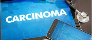Dose-response association seen for basal cell and especially squamous cell carcinoma Dose-response association seen for basal cell and especially squamous cell carcinoma
