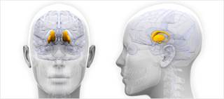Greater activity was recorded in the right anterior hypothalamic region in people with chronic vs episodic migraine. Greater activity was recorded in the right anterior hypothalamic region in people with chronic vs episodic migraine.
