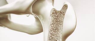 Studies on whether osteoporotic drugs are effective in preventing secondary fractures have been limited Studies on whether osteoporotic drugs are effective in preventing secondary fractures have been limited