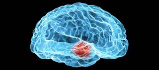 In adjusted analyses, increased risk seen for all-severity TBI, mild TBI, moderate-severe TBI In adjusted analyses, increased risk seen for all-severity TBI, mild TBI, moderate-severe TBI