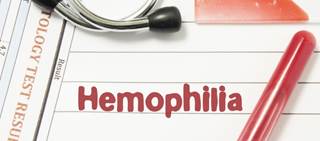 HAVEN 2 is a clinical trial evaluating the efficacy, safety and pharmacokinetics of emicizumab in children with hemophilia A HAVEN 2 is a clinical trial evaluating the efficacy, safety and pharmacokinetics of emicizumab in children with hemophilia A