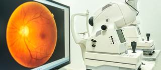 In offspring of macular degeneration patients, lutein plus zeaxanthin did not lead to density change In offspring of macular degeneration patients, lutein plus zeaxanthin did not lead to density change