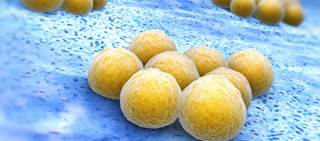 Dalbavancin is a long-acting lipoglycopeptide effective against the gram-positive bacteria responsible for ABSSSI Dalbavancin is a long-acting lipoglycopeptide effective against the gram-positive bacteria responsible for ABSSSI