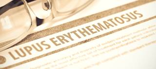 Patients with SLE were treated with rituximab specifically for SLE-associated immune cytopenia Patients with SLE were treated with rituximab specifically for SLE-associated immune cytopenia