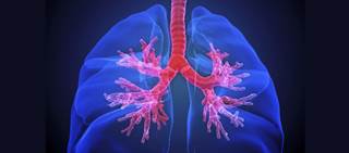 Worse airflow decline-free survival than placebo after allogeneic hematopoietic stem cell transplant Worse airflow decline-free survival than placebo after allogeneic hematopoietic stem cell transplant