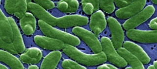 Clinicians immediately suspected V. vulnificus Clinicians immediately suspected V. vulnificus