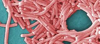 <i>Legionella</i> bacteria detected in water systems <i>Legionella</i> bacteria detected in water systems