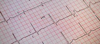 Researchers from USPSTF reviewed evidence on screening for and the treatment of nonvalvular AF among adults ≥65 years Researchers from USPSTF reviewed evidence on screening for and the treatment of nonvalvular AF among adults ≥65 years