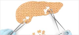 “Significant confusion” seen with regards to dosing and administration of pancreatic enzymes “Significant confusion” seen with regards to dosing and administration of pancreatic enzymes