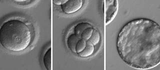Embryos after co-injection of a gene-correcting enzyme and sperm donor with a genetic mutation known to cause hypertrophic cardiomyopathy (OHSU) Embryos after co-injection of a gene-correcting enzyme and sperm donor with a genetic mutation known to cause hypertrophic cardiomyopathy (OHSU)
