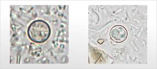 The standard treatment for cyclosporiasis is trimethoprim/sulfamethoxazole (TMP/SMX) The standard treatment for cyclosporiasis is trimethoprim/sulfamethoxazole (TMP/SMX)