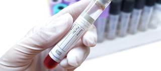 Preoperative administration of liraglutide linked to lower post-op glucose, increase in pre-op nausea Preoperative administration of liraglutide linked to lower post-op glucose, increase in pre-op nausea