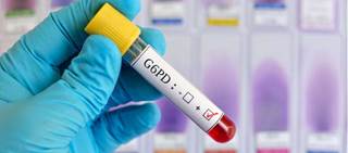 Burosumab is an investigational recombinant fully human monoclonal IgG1 antibody Burosumab is an investigational recombinant fully human monoclonal IgG1 antibody