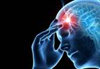 Galcanezumab Effective in Phase 3 Episodic Cluster Headache Study Galcanezumab Effective in Phase 3 Episodic Cluster Headache Study