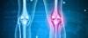Positive Results for Novel Osteoarthritis Pain Treatment in Phase 3 Trial Positive Results for Novel Osteoarthritis Pain Treatment in Phase 3 Trial