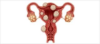Ulipristal acetate is a selective progesterone receptor modulator Ulipristal acetate is a selective progesterone receptor modulator