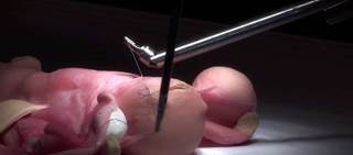 The Senhance System is controlled by a human surgeon at a console, so is not an actual robot The Senhance System is controlled by a human surgeon at a console, so is not an actual robot