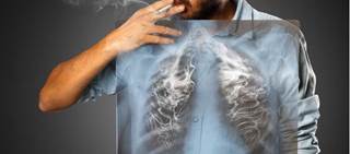 Further results from the guidelines will be shared at the CHEST Annual Meeting 2017 Further results from the guidelines will be shared at the CHEST Annual Meeting 2017
