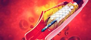 Clinicians call for cardiology guideline revisions to downgrade the recommendation Clinicians call for cardiology guideline revisions to downgrade the recommendation
