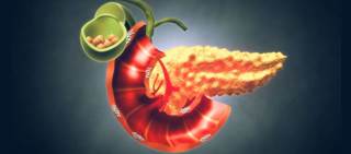 Cystic fibrosis and chronic pancreatitis represent the most common etiologies Cystic fibrosis and chronic pancreatitis represent the most common etiologies