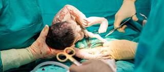 Findings support use of prophylactic azithromycin at the time of cesarean delivery Findings support use of prophylactic azithromycin at the time of cesarean delivery