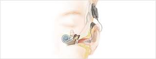 The approval was based on a clinical study of 39 patients who had the implant for at least 1 year The approval was based on a clinical study of 39 patients who had the implant for at least 1 year