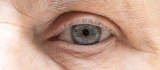 A clinical study of 600 patients was conducted to evaluate the safety and effectiveness of the RxSight Light Adjustable Lens and Light Delivery Device A clinical study of 600 patients was conducted to evaluate the safety and effectiveness of the RxSight Light Adjustable Lens and Light Delivery Device